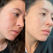 Vue rapprochée de la crème hydratante réparatrice appliquée sur la peau