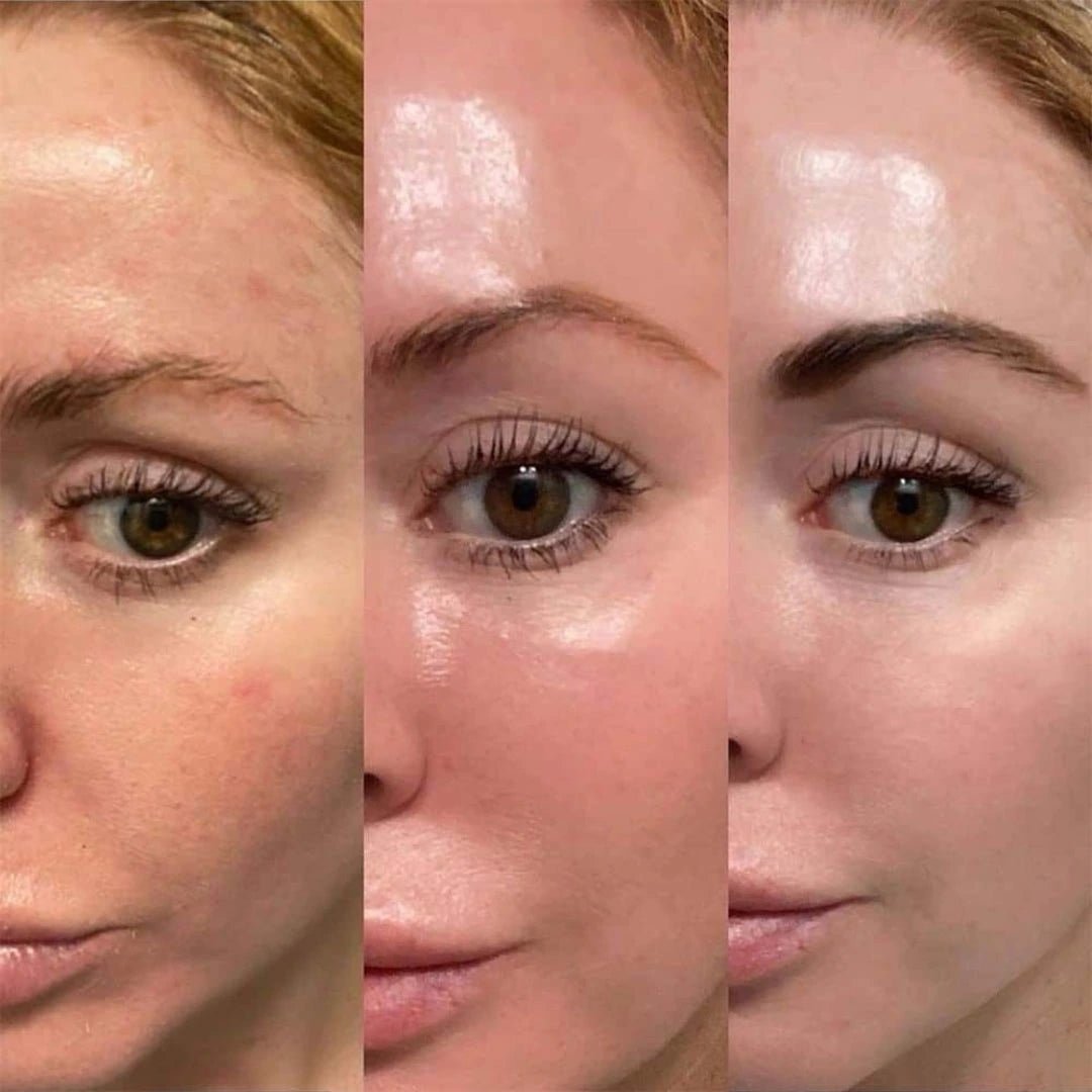 Texture légère et hydratante du serum Maru Derm appliquée sur la peau