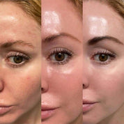 Texture légère et hydratante du serum Maru Derm appliquée sur la peau