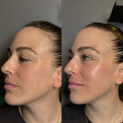 Texture légère et lumineuse du serum vitamin c maruderm appliquée sur la peau