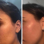 Ingrédients naturels et vitamine C pure dans le serum maruderm