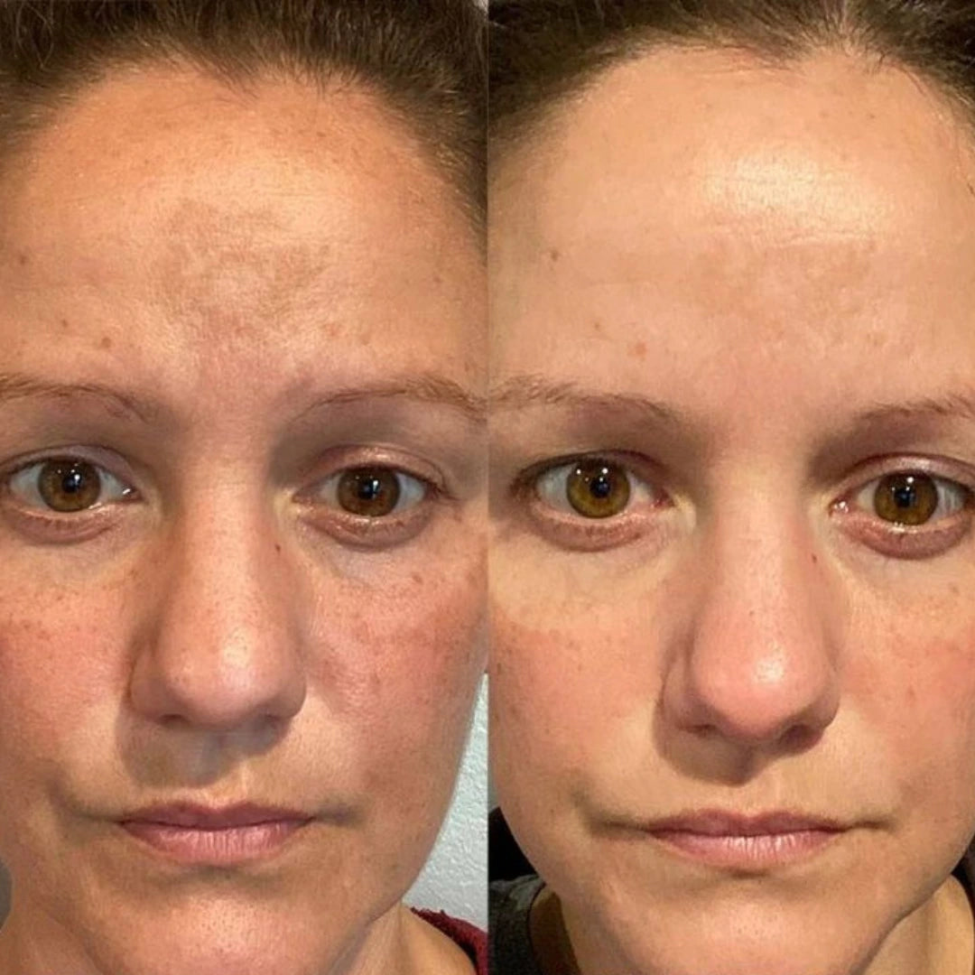 Présentation du serum vitamin c maruderm avec fond lumineux et naturel