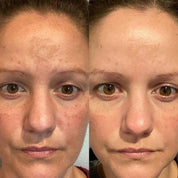 Présentation du serum vitamin c maruderm avec fond lumineux et naturel